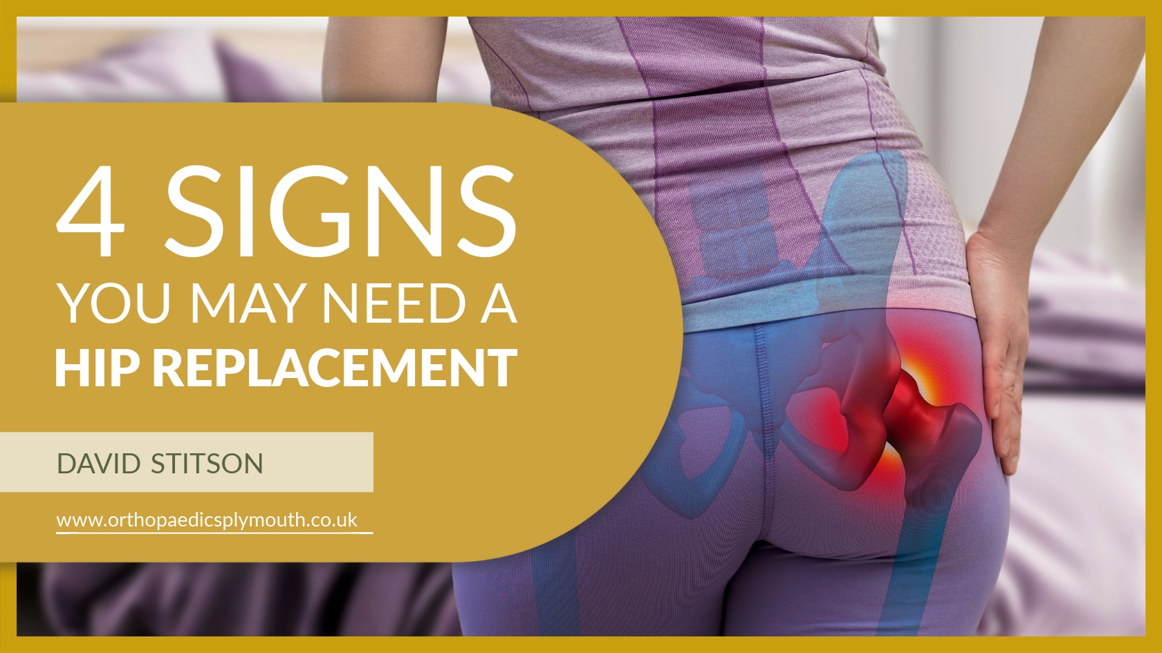 4 Signs You May Need a Hip Replacement | David Stitson, Consultant Orthopaedic Surgeon in Plymouth.