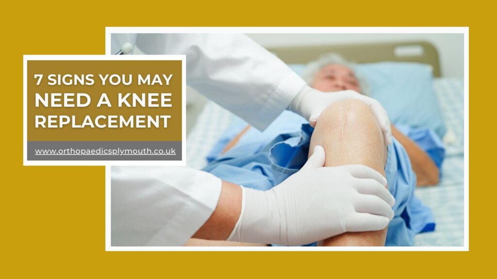 7 Signs you may need a knee replacement