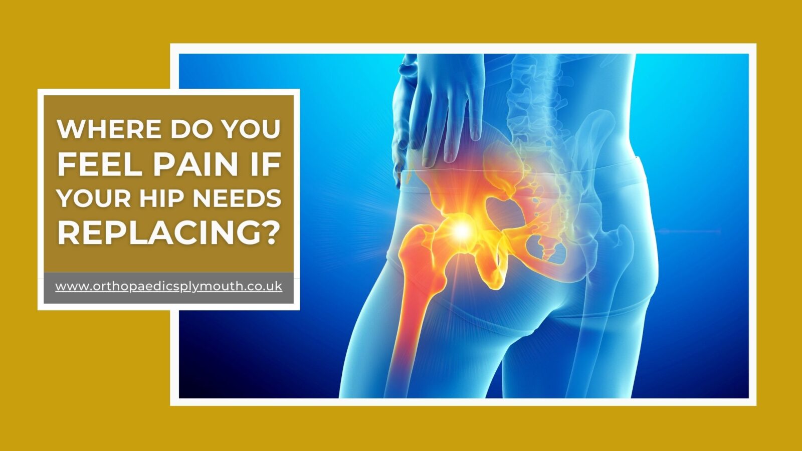 Where Do You Feel Pain If Your Hip Needs Replacing? David Stitson | Orthopaedic Surgeon | The Nuffield Plymouth