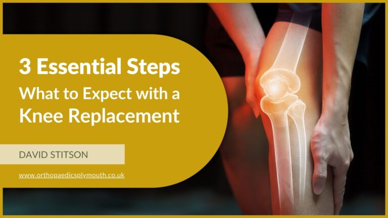 3 Essential Steps | What to Expect with Knee Replacement Surgery