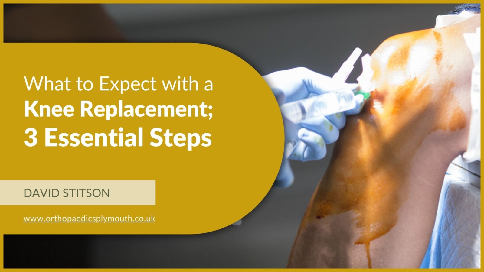 What to Expect with Knee Replacement Surgery; 3 Essential Steps | Mr Stitson, Consultant Orthopaedic Surgeon in Plymouth.