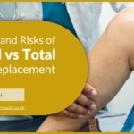 The Benefits and Risks of Partial vs Total Knee Replacement | David Stitson Orthopaedic Surgeon | Plymouth