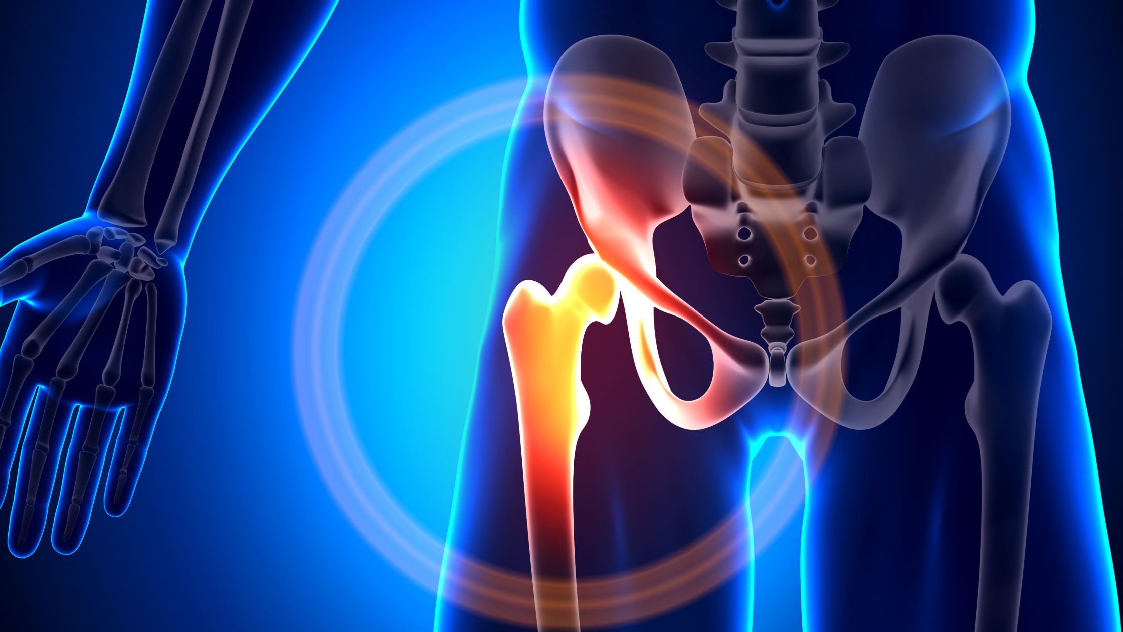 Total Hip Replacement Suitability Assessment | Mr David Stitson | CONSULTANT ORTHOPAEDIC SURGEON | Plymouth Total Hip Replacement Suitability Assessment | David Stitson, Consultant Orthopaedic Surgeon in Plymouth.