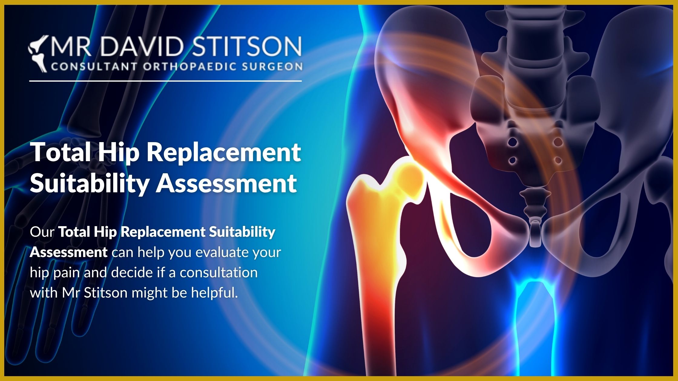 Total Hip Replacement Suitability Assessment | David Stitson, Consultant Orthopaedic Surgeon in Plymouth.