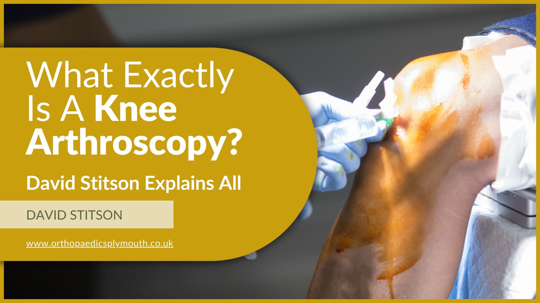 What Exactly Is A Knee Arthroscopy? | David Stitson, Consultant Orthopaedic Surgeon in Plymouth.