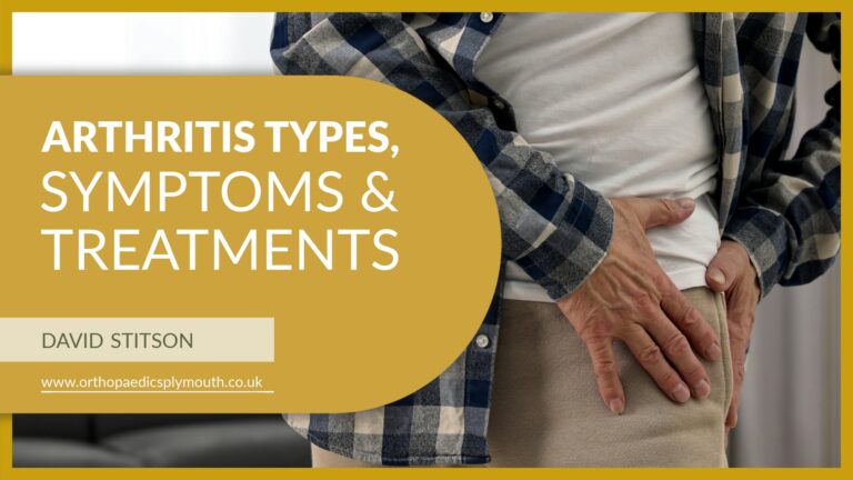 Arthritis Types, Symptoms & Treatments | David Stitson, Consultant Orthopaedic Surgeon in Plymouth.