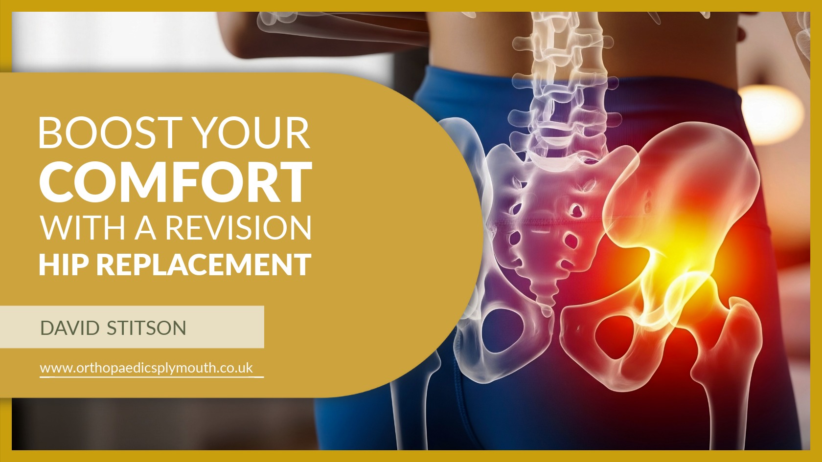 Boost Your Comfort with Revision Hip Replacement Surgery | David Stitson | Consultant Orthopaedic Surgeon | Plymouth.