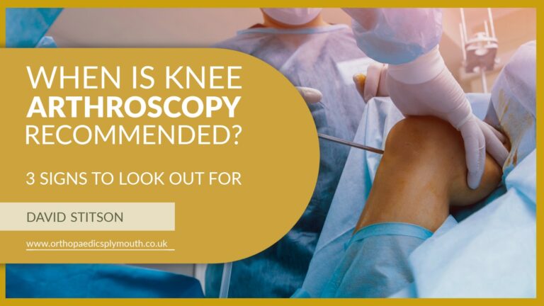 When is knee arthroscopy recommended | David Stitson, Consultant Orthopaedic Surgeon in Plymouth.