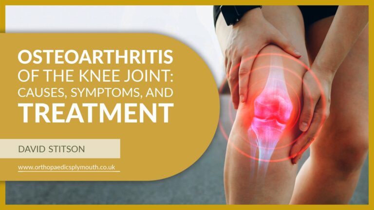 Private knee surgery offers highly effective, long-lasting solutions for osteoarthritis relieving pain, restoring function, and improving mobility. Mr David Stitson | Consultant Orthopaedic Surgeon | Plymouth