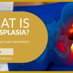What is Hip Dysplasia? | David Stitson, Consultant Orthopaedic Surgeon in Plymouth.