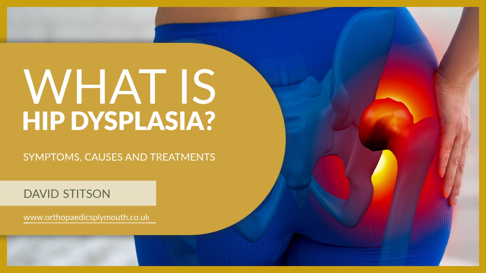 What is Hip Dysplasia? | David Stitson, Consultant Orthopaedic Surgeon in Plymouth.