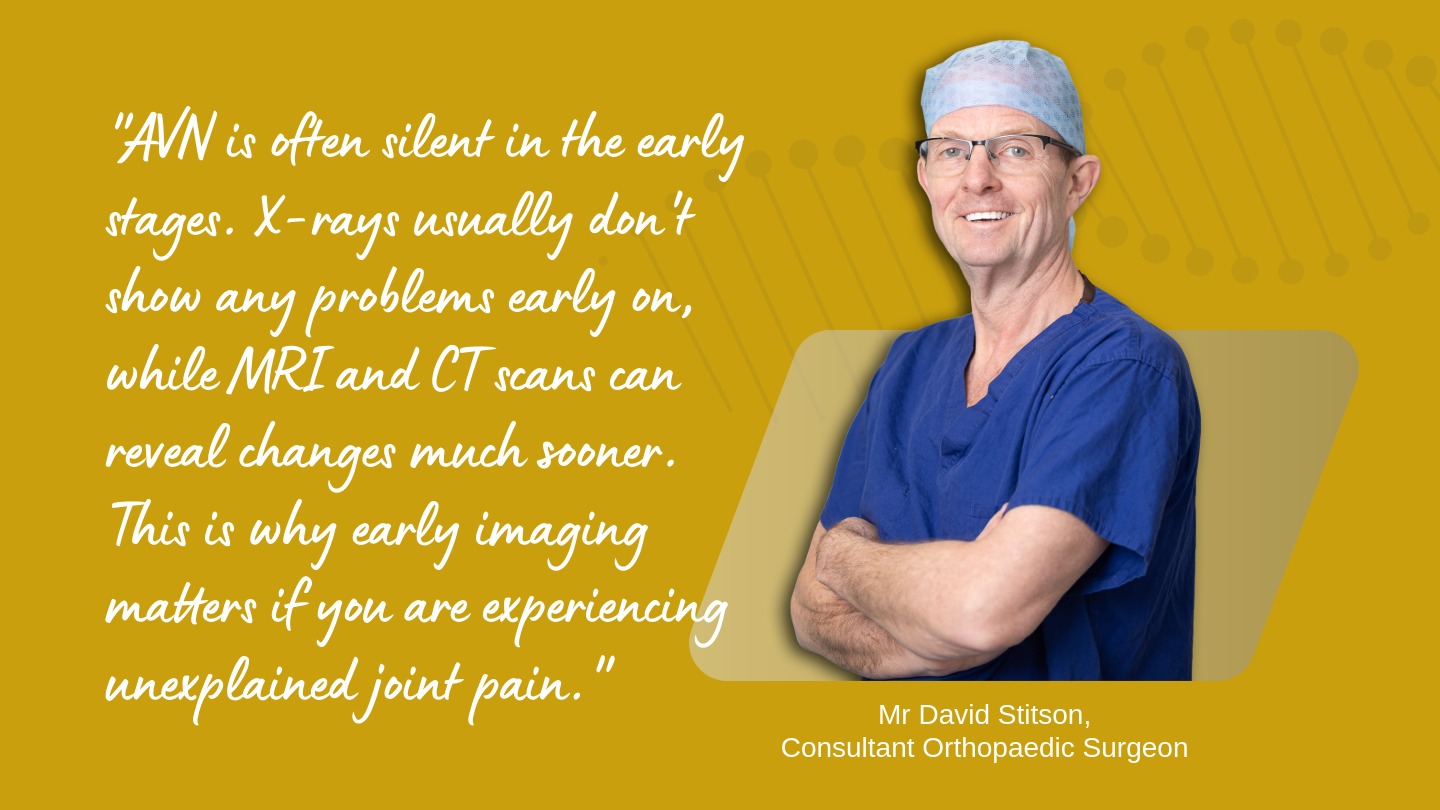 AVN is often silent in the early stages. X-rays usually don't show any problems early on, while MRI and CT scans can reveal changes much sooner. This is why early imaging matters if you are experiencing unexplained joint pain.