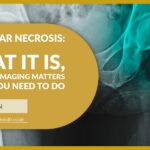 Avascular Necrosis: What It Is & What You Need To Do | Mr David Stitson | CONSULTANT ORTHOPAEDIC SURGEON | Plymouth Avascular Necrosis: What It Is, why early imaging matters & What You Need To Do | David Stitson, Consultant Orthopaedic Surgeon in Plymouth.