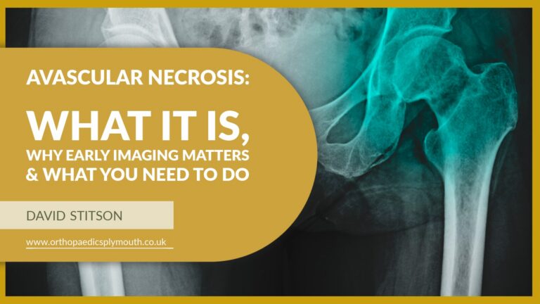 Avascular Necrosis: What It Is, why early imaging matters & What You Need To Do | David Stitson, Consultant Orthopaedic Surgeon in Plymouth.