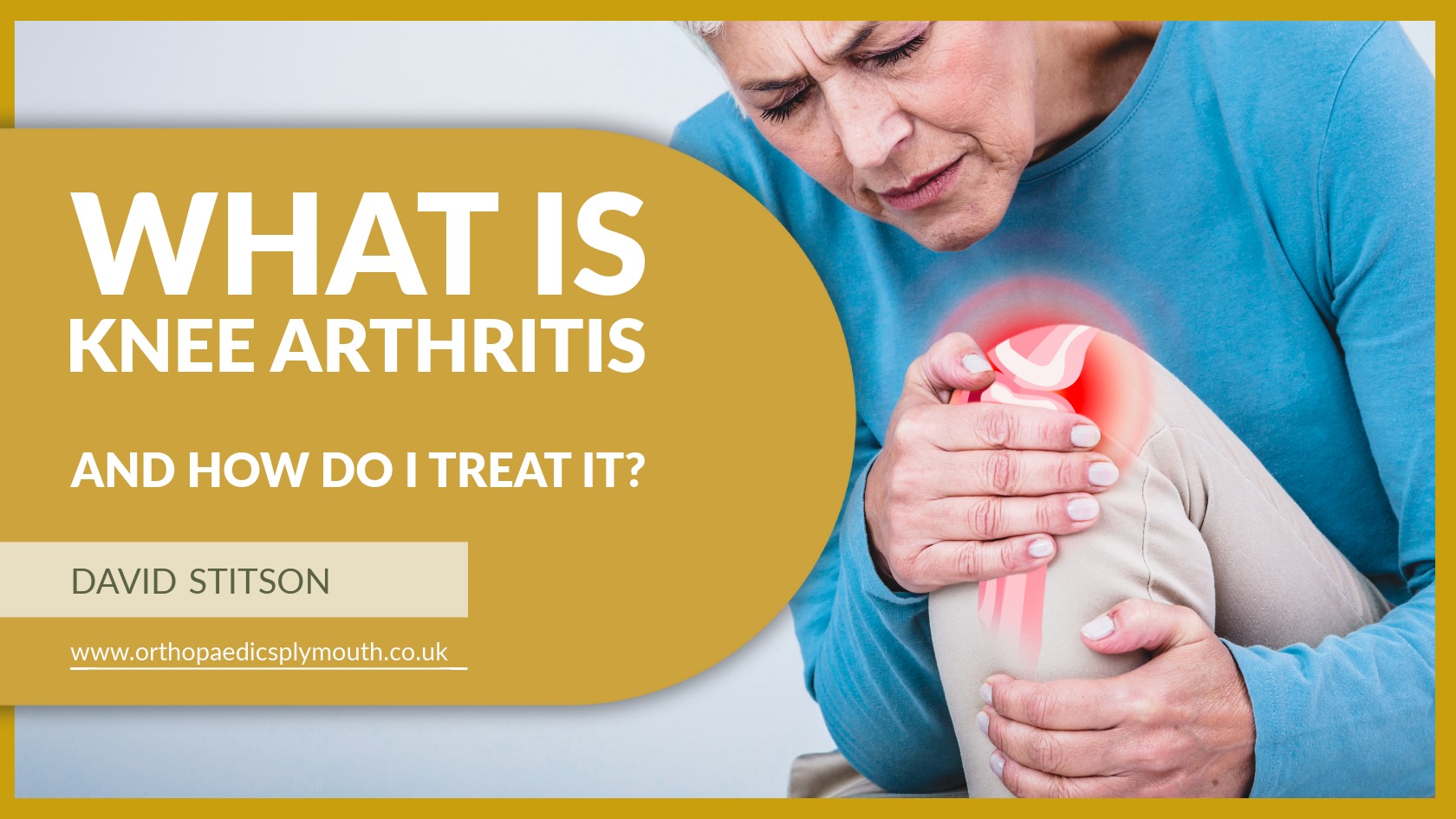 What Is Knee Arthritis and How Do I Treat It? | David Stitson, Consultant Orthopaedic Surgeon in Plymouth.