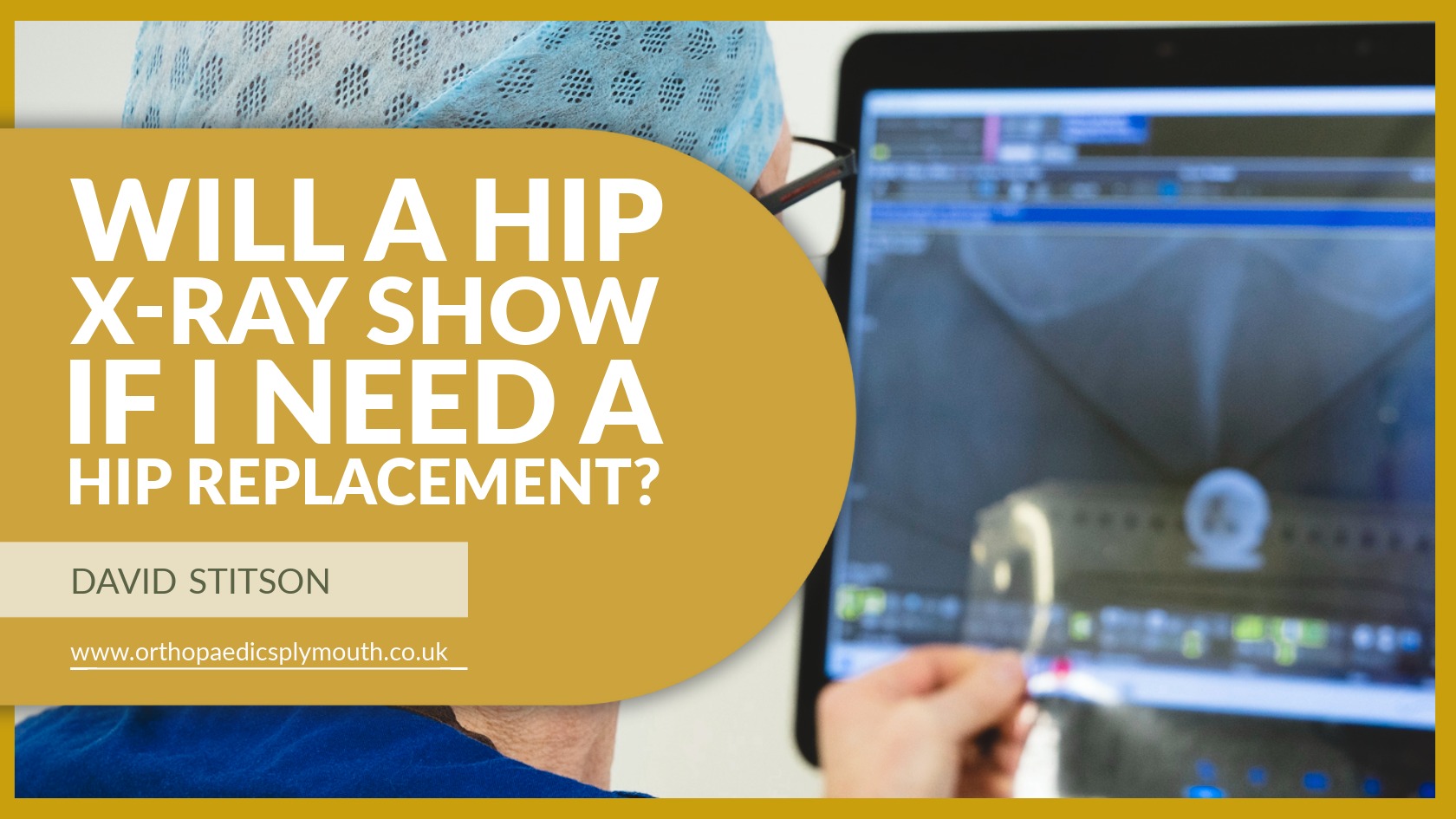 Will a Hip X-Ray Show If I Need a Hip Replacement? | Mr David Stitson | CONSULTANT ORTHOPAEDIC SURGEON | Plymouth Will a Hip X-Ray Show If I Need a Hip Replacement? | David Stitson, Consultant Orthopaedic Surgeon in Plymouth.