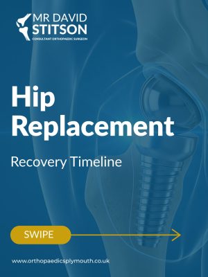3 Life-Changing Stages In Your Hip Replacement Recovery Timeline | Mr David Stitson | Consultant Orthopaedic Surgeon | Plymouth