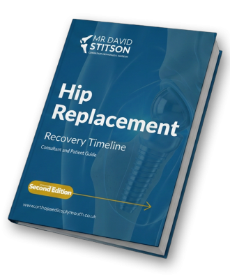 Hip Replacement Recovery | David Stitson, Consultant Orthopaedic Surgeon in Plymouth Hip Replacement Recovery | David Stitson, Consultant Orthopaedic Surgeon in Plymouth