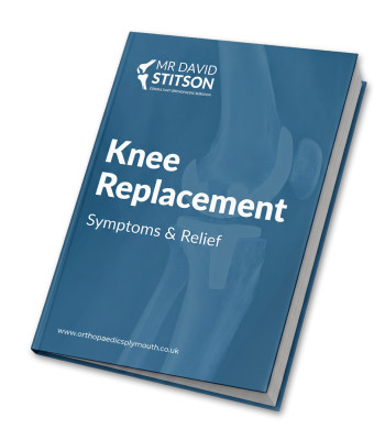 Knee Replacement Symptoms | David Stitson, Consultant Orthopaedic Surgeon in Plymouth Knee Replacement Symptoms | David Stitson, Consultant Orthopaedic Surgeon in Plymouth